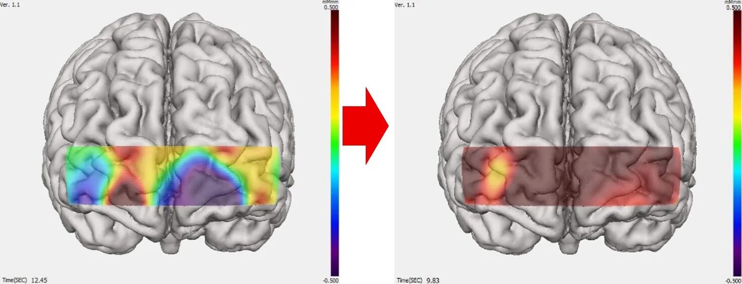 脳活動のヒートマップ